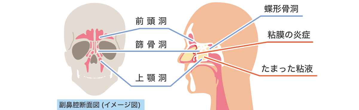 副鼻腔断面図