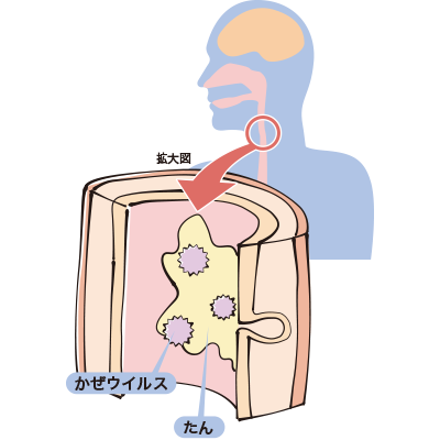 せき・たんはなぜ起こる？