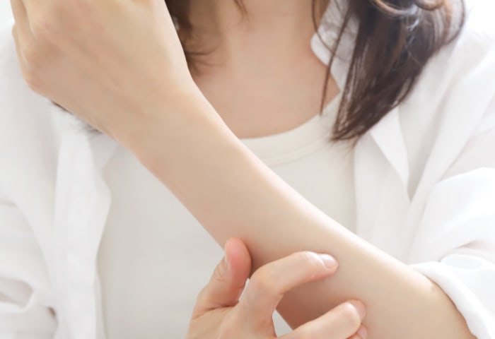 かゆいぶつぶつは湿疹（皮膚炎）？原因や症状、予防・対処法を解説【医師監修】