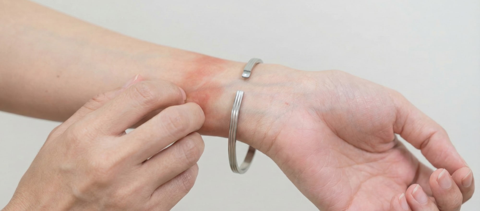 かぶれ（接触皮膚炎）とは？身近にある原因や対処・予防法を解説【医師監修】