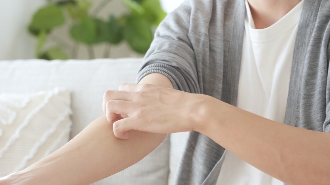 かぶれ（接触皮膚炎）の種類