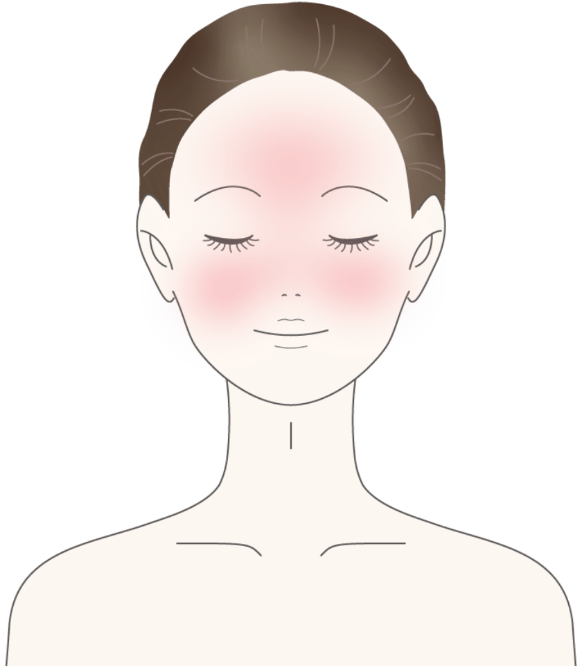 日光過敏症(にっこうかびんしょう)（光線過敏症(こうせんかびんしょう)）