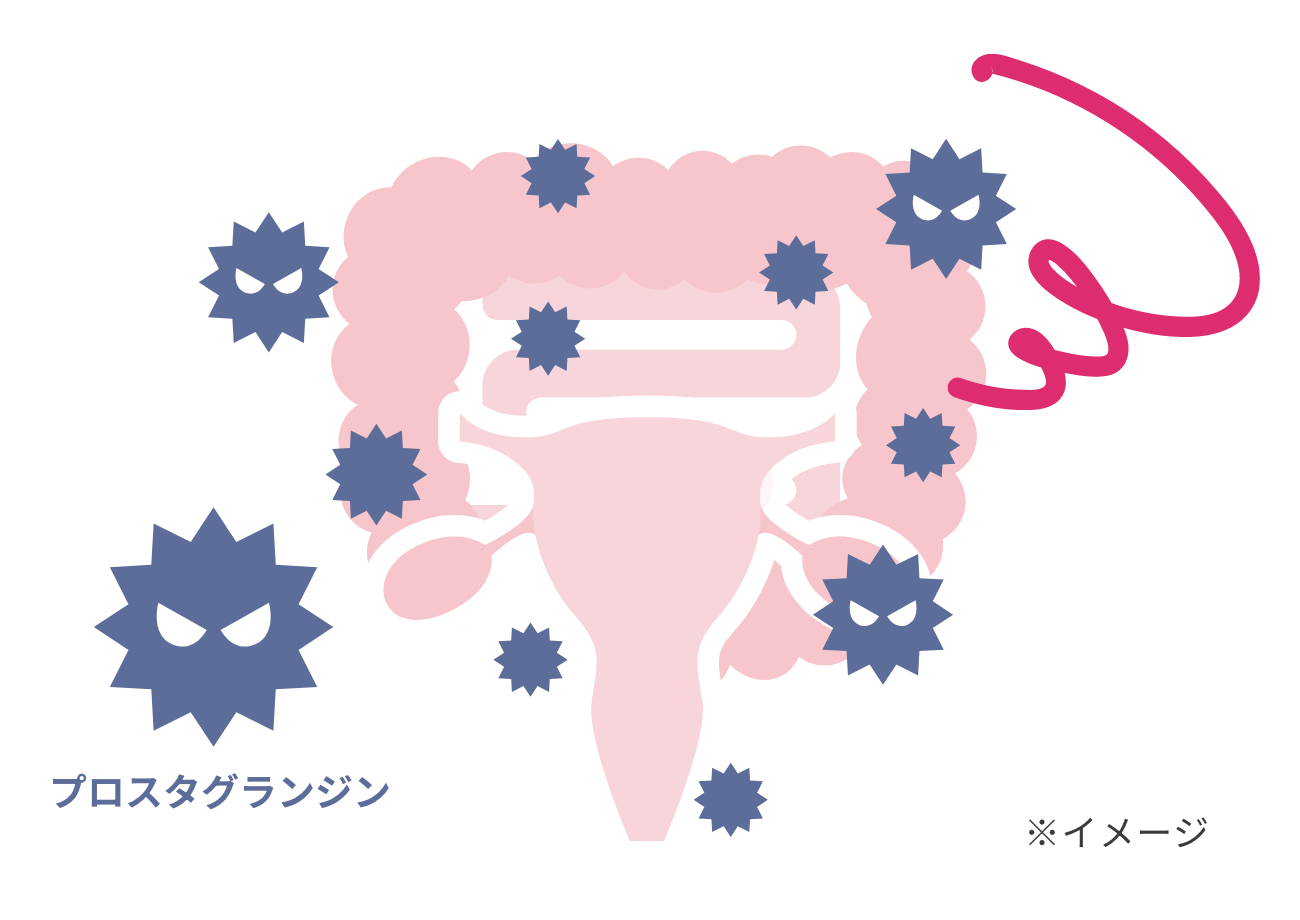 子宮内膜でプロスタグランジンが過剰に産生されているイメージ