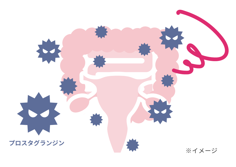 子宮内膜でプロスタグランジンが過剰に産生されているイメージ