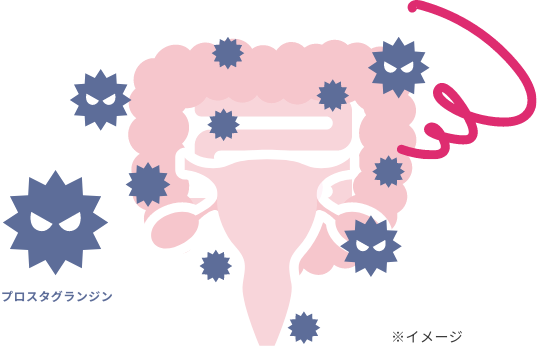 子宮内膜でプロスタグランジンが過剰に産生されているイメージ